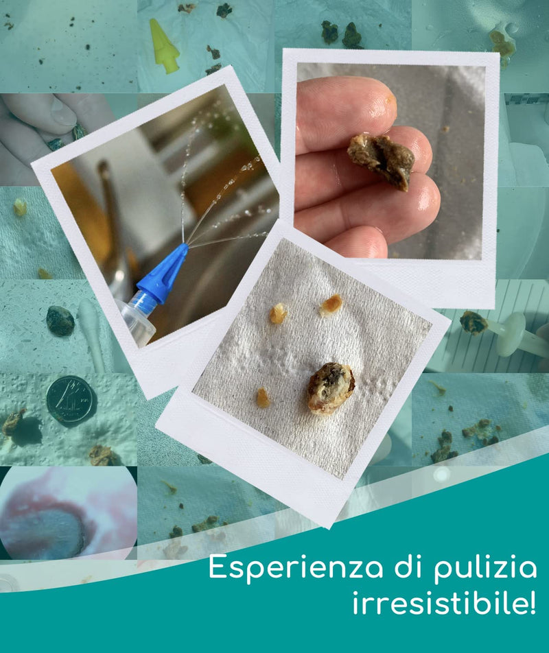 Kit Siringa Pulisci Orecchie – Siringa per Tappi Orecchie Con 3 Punte a Getto Quadruplo –Kit per Pulizia Orecchie Di Uso Domestico - Migliora La Chiarezza L’Udito