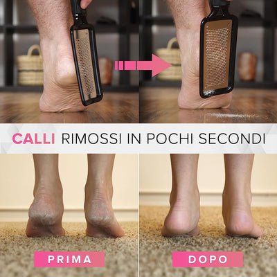 Lima per Piedi ULTIMATE Rimozione Della Pelle Dura - Raspa PROFESSIONALE per I Calli  MEGAFILE Pedicure Pietra Pomice