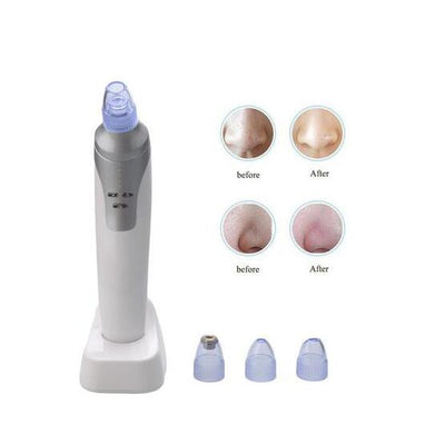 Electronic Blackhead Remover