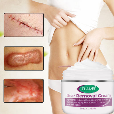 Skin Rebound Scarless Cream Scar Removal Cream Face Cream for Face Acne Scar Stretch Marks Skin Repair Face Cream