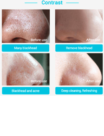 Blackhead Nasal Membrane with 60 Sheets of Blackhead Tearing Powerful to Acne T Area Care