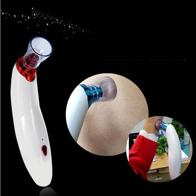 Electric Blackhead Suction Device to Remove Acne, Horny Pores and Cleansing Multifunctional Cupping Cleaner