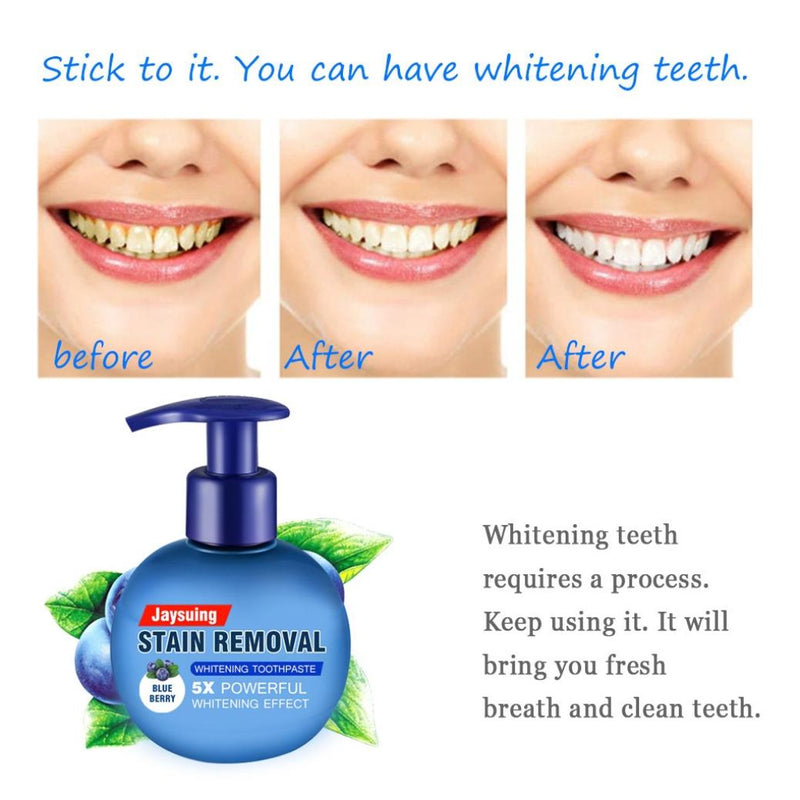 Stain Removal Whitening Toothpaste Fight Bleeding Gums Toothpaste